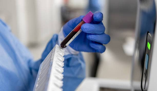 5-part WBC differential — the most diagnostically critical parameter in African medicine.