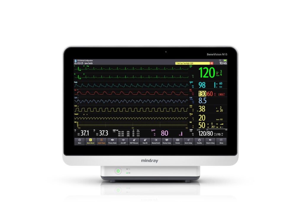 Patient Monitors